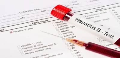 Anti Hepatitis B Surface Antigen (Anti-HBs) – Total Test