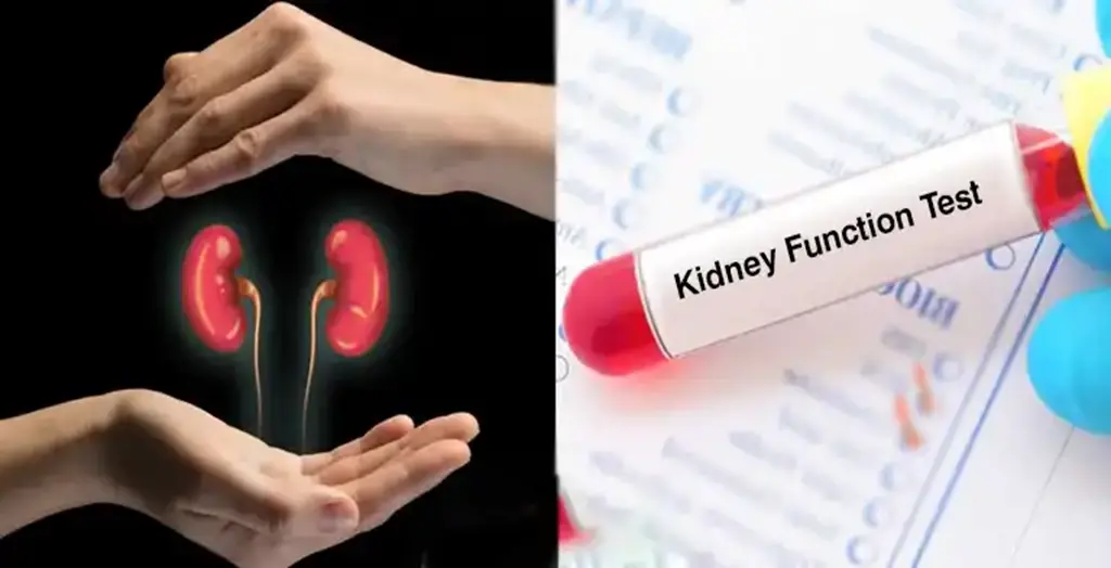 1691413279-Kidney Function Test (1)