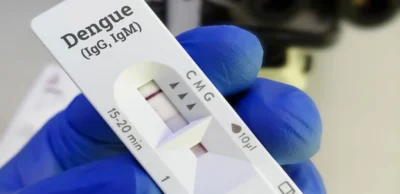 Dengue IgG Test