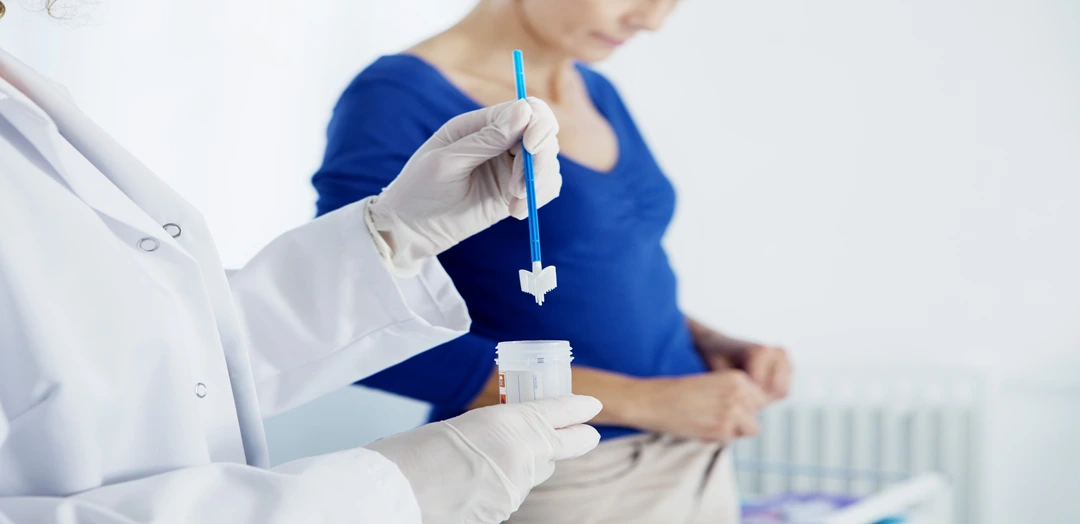 Pap Smear Test (Cervical Cancer Screening Test)