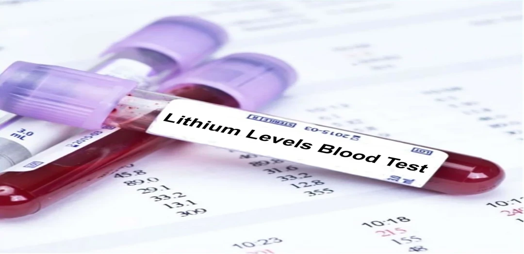 Lithium Blood Test