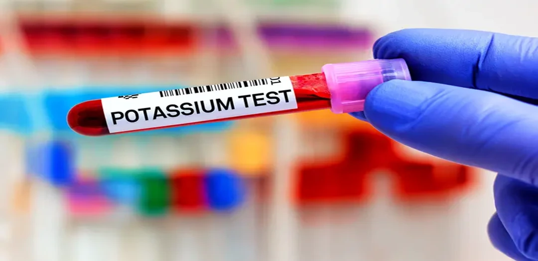 Potassium Blood Test