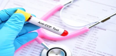 Anti-CCP Body Test (Anti Cyclic Citrullinated Peptide)