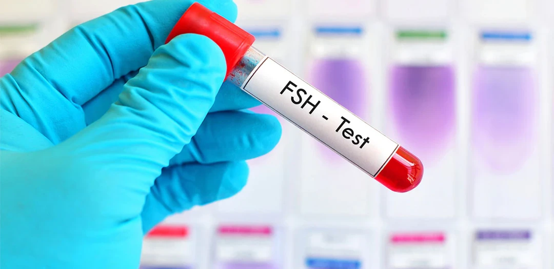 Follicle Stimulating Hormone (FSH) Test