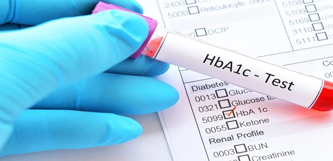 HbA1c Test
