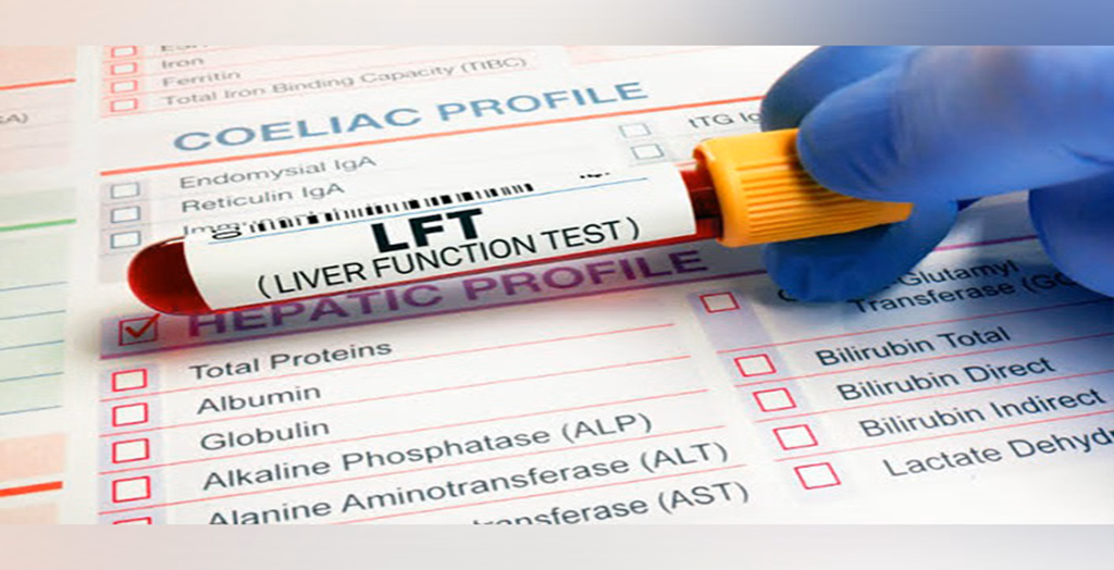 Liver Function Test (LFT) Profile