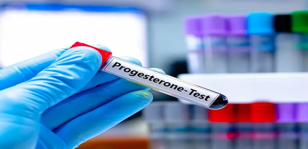 Progesterone Test