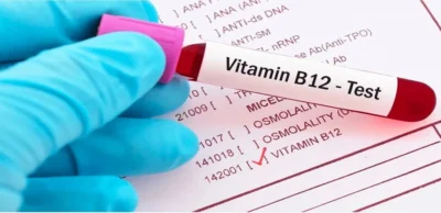Vitamin B12 Test