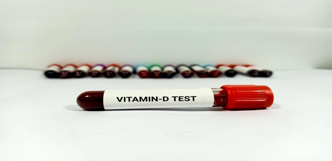 Vitamin D Test