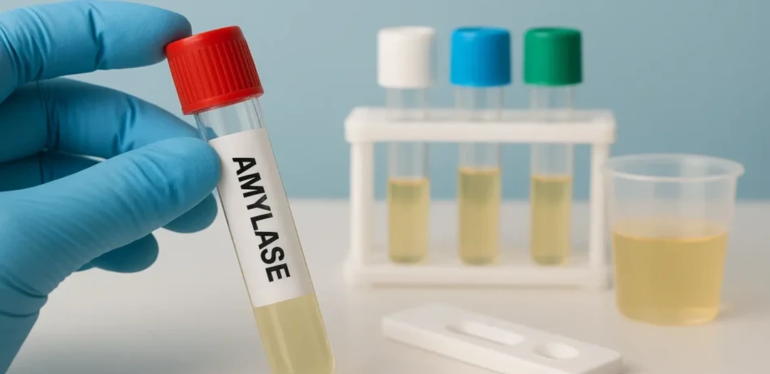 Amylase Blood Test
