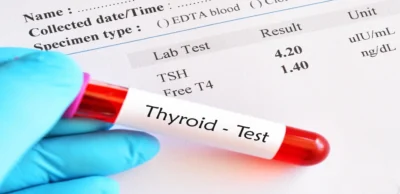 Thyroid Profile Test