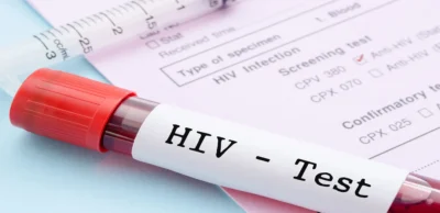 HIV 1 & HIV 2 Antibody Test